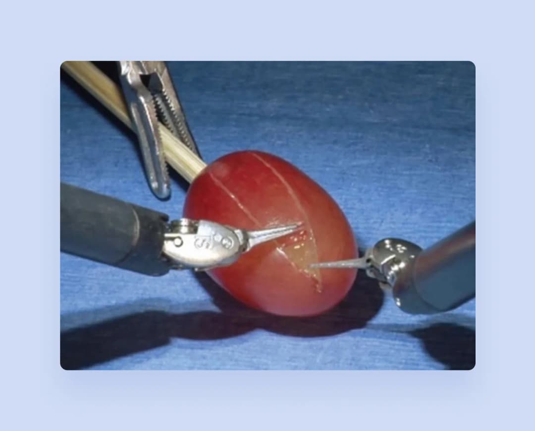 robotic surgery equipment in a connected operating room