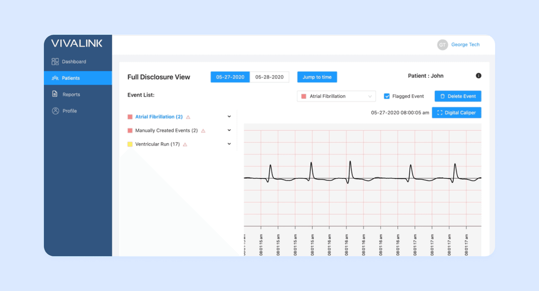 Wearable biometrics data platform screenshot