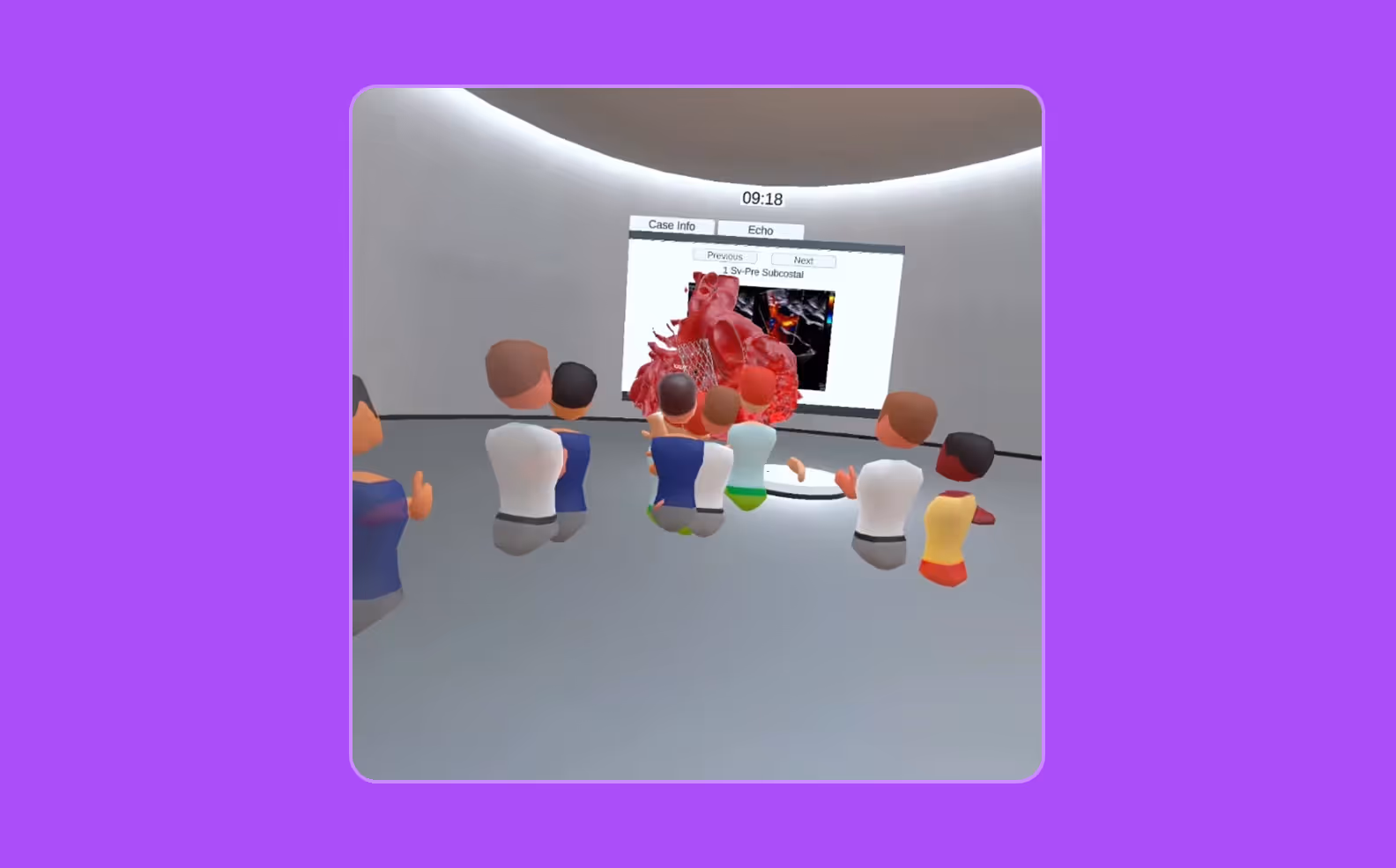 Vhearts snapshot of heart model